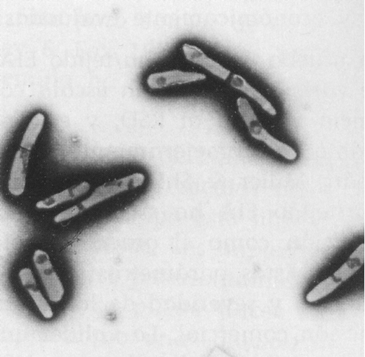 2.  Enfermedades causadas por bacterias.